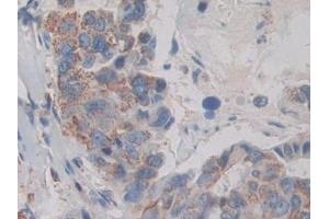 Immunohistochemistry (IHC) image for anti-Mitogen-Activated Protein Kinase-Activated Protein Kinase 2 (MAPKAPK2) (AA 139-367) antibody (ABIN7441769)