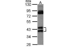 WB Image Sample (30 ug of whole cell lysate) A: Hela 10% SDS PAGE antibody diluted at 1:1000 (HNRNPAB Antikörper)