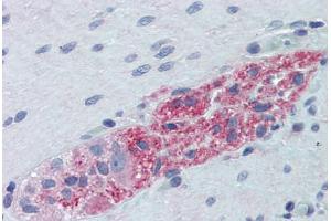 Human Small Intestine, Myenteric Plexus: Formalin-Fixed, Paraffin-Embedded (FFPE)