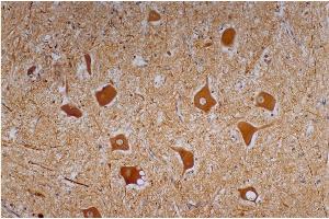 Immunohistochemistry of paraffin-embedded sections (human cerebellum) Immunohistochemistry staining of human cerebellum (paraffin-embedded sections) with anti-Neurofilament heavy protein (NF-01).