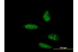 Immunofluorescence of monoclonal antibody to ATOH1 on HeLa cell. (ATOH1 Antikörper  (AA 266-354))