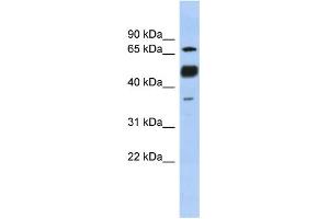 WB Suggested Anti-NFATC1 Antibody Titration:  0. (NFATC1 Antikörper  (N-Term))
