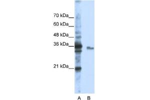 WB Suggested Anti-EXOSC3 Antibody Titration:  0. (EXOSC3 Antikörper  (Middle Region))