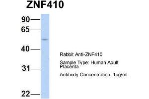 Host: Rabbit Target Name: ZNF410 Sample Type: Human Adult Placenta Antibody Dilution: 1. (ZNF410 Antikörper  (N-Term))