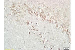 Formalin-fixed and paraffin embedded: rat brain tissue labeled with Anti-GABRB1 Polyclonal Antibody (ABIN669756), Unconjugated at 1:200 followed by conjugation to the secondary antibody and DAB staining (GABBR1 Antikörper  (AA 651-750))