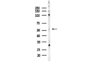 anti-rho Guanine Nucleotide Exchange Factor (GEF) 5 (ARHGEF5) (Internal Region) antibody