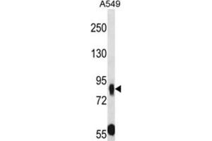 Western Blotting (WB) image for anti-Mucin and Cadherin-Like (CDHR5) antibody (ABIN2997917) (CDHR5 Antikörper)