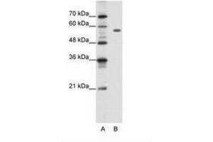 Image no. 1 for anti-Pre-B-Cell Leukemia Homeobox Protein 2 (PBX2) (C-Term) antibody (ABIN202503) (PBX2 Antikörper  (C-Term))
