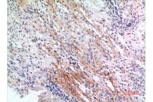 Immunohistochemistry (IHC) analysis of paraffin-embedded Human Brain, antibody was diluted at 1:100. (IFITM1 Antikörper  (N-Term))