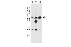 GATM Antibody (N-term) (ABIN654401 and ABIN2844143) western blot analysis in HL-60(lane 1),MDA-M(lane 2),K562(lane 3) cell line lysates (35 μg/lane). (GATM Antikörper  (N-Term))