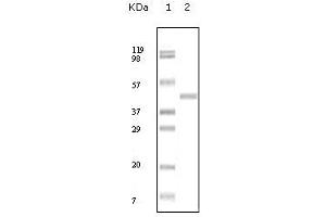 Western Blot showing ABL2 antibody used against truncated ABL2 recombinant protein.