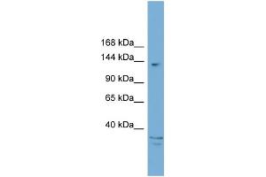 WB Suggested Anti-ARID5B  Antibody Titration: 0. (ARID5B Antikörper  (C-Term))