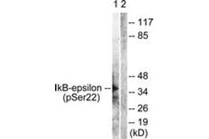 Western blot analysis of extracts from Jurkat cells treated with TNF-a 20ng/ml 30', using IkappaB-epsilon (Phospho-Ser22) Antibody. (IkappaB-epsilon Antikörper  (pSer22))