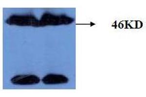 Western Blotting (WB) image for anti-Microtubule-Associated Protein tau (MAPT) (AA 177-187), (pThr181) antibody (ABIN1108153) (MAPT Antikörper  (pThr181))