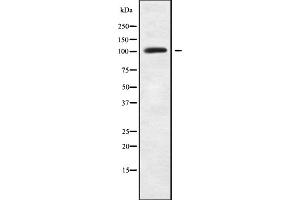 Western blot analysis of LARP2 using HUVEC whole cell lysates (LARP1B Antikörper  (Internal Region))