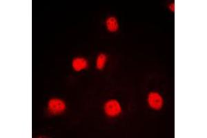 Immunofluorescent analysis of GATA1 staining in K562 cells. (GATA1 Antikörper  (Center))