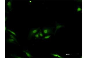 Immunofluorescence of purified MaxPab antibody to ORC6L on HeLa cell. (ORC6 Antikörper  (AA 1-252))