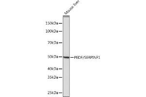 Western blot analysis of extracts of Mouse liver, using PEDF/SERPINF1 Rabbit mAb (ABIN7270247) at 1:1000 dilution. (PEDF Antikörper)