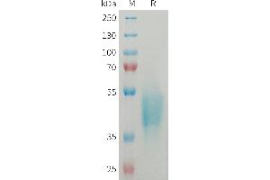 SDS-PAGE (SDS) image for Osteoclast Associated Receptor (OSCAR) (AA 19-282) protein (His tag) (ABIN7538463)