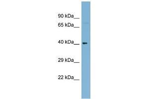 WB Suggested Anti-C1orf92 Antibody Titration: 0.