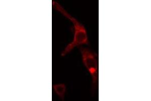 ABIN6272441 staining MCF7 cells by IF/ICC. (TBL2 Antikörper  (C-Term))