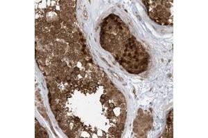 Immunohistochemical staining of human testis with DHX36 polyclonal antibody  shows strong nuclear and cytoplasmic positivity in cells of seminiferus ducts at 1:20-1:50 dilution. (DHX36 Antikörper)