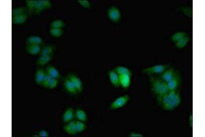 Immunofluorescent analysis of HepG2 cells using ABIN7175485 at dilution of 1:100 and Alexa Fluor 488-congugated AffiniPure Goat Anti-Rabbit IgG(H+L) (VAMP7 Antikörper  (AA 2-186))