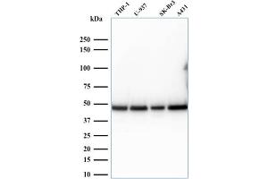 Western Blot Analysis of human THP-1, U937, SK-BR3, and A431 cell lysates. (RPSA/Laminin Receptor Antikörper)