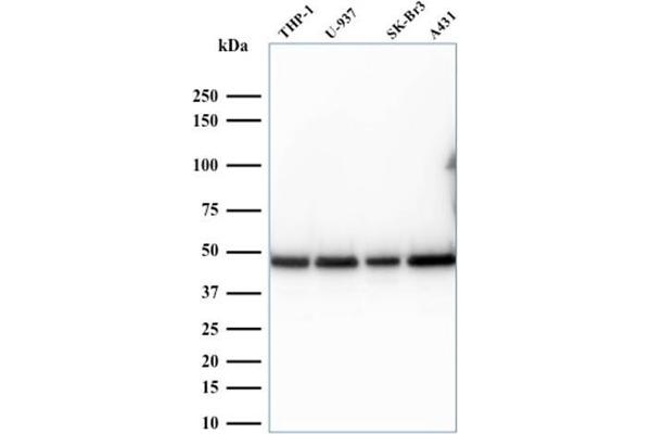 RPSA/Laminin Receptor anticorps