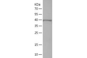 IL17 Receptor B Protein (AA 317-494) (His-IF2DI Tag)