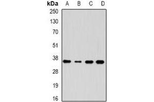 Western blot analysis of AKR7A3 expression in HepG2 (A), HT29 (B), mouse kidney (C), mouse liver (D) whole cell lysates. (AKR7A3 Antikörper)