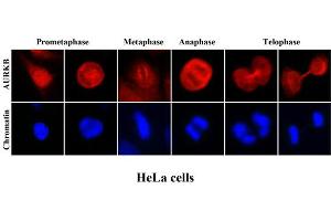 ICC/IF analysis of human HeLa cells stained with Hoechst 3342 (Blue) for chromatin staining and monoclonal anti-human Aurora kinase B antibody (1:2000) with Texas Red (Red). (Aurora Kinase B Antikörper  (AA 1-344))
