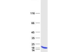 C19ORF53 Protein (Myc-DYKDDDDK Tag)