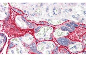 Detection of CCK in Human Placenta Tissue using Polyclonal Antibody to Cholecystokinin (CCK) (Cholecystokinin Antikörper  (AA 1-115))