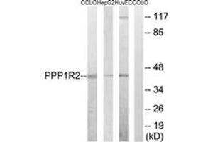Western blot analysis of extracts from HuvEc/HepG2/COLO cells, using PPP1R2 (Ab-44) Antibody.