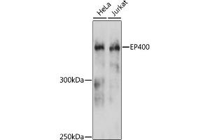 Western blot analysis of extracts of various cell lines, using EP400 antibody (ABIN6127822, ABIN6140195, ABIN6140196 and ABIN6215738) at 1:3000 dilution. (EP400 Antikörper  (AA 90-330))