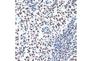 Immunohistochemistry (IHC) image for anti-SET Nuclear Oncogene (SET) antibody (ABIN7270265)