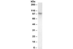Western blot testing of human cerebellum lysate with PRDM1 antibody at 1ug/ml. (PRDM1 Antikörper)