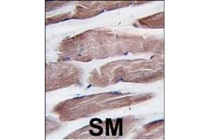Formalin-fixed and paraffin-embedded human skeletal muscle tissue reacted with hPI3KC3 (N-term) (ABIN1882112 and ABIN2849998) , which was peroxidase-conjugated to the secondary antibody, followed by DAB staining. (PIK3C3 Antikörper  (N-Term))