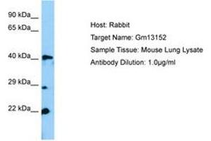 Image no. 1 for anti-Zinc Finger Protein 982 (Zfp982) (N-Term) antibody (ABIN6749822) (Zfp982 Antikörper  (N-Term))