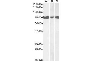 ABIN570944 (1µg/ml) staining of Human Pancreas (A), Heart (B) and Skeletal Muscle (C) lysates (35µg protein in RIPA buffer). (ITPKC Antikörper  (Internal Region))