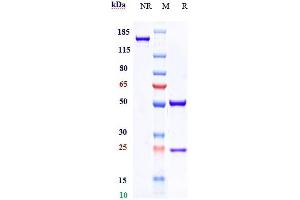Anti-GPNMB Reference Antibody (glembatumumab) on SDS-PAGE under reducing (R) condition.
