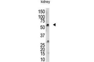 Western Blotting (WB) image for anti-RanBP-Type and C3HC4-Type Zinc Finger Containing 1 (RBCK1) antibody (ABIN3001446) (RBCK1 Antikörper)