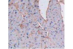 IHC-P analysis of Mouse Heart Tissue, with DAB staining. (Albumin Antikörper)