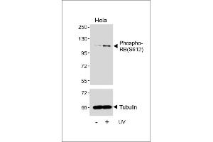 Western blot analysis of lysates from Hela cell line, untreated or treated with UV(2h), using Phospho-RB Antibody (upper) or Tubulin (lower). (Retinoblastoma 1 Antikörper  (pSer612))
