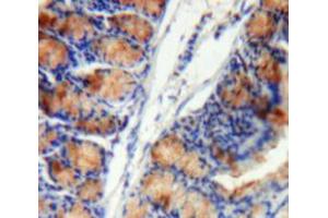Immunohistochemistry (IHC) image for anti-serpin Peptidase Inhibitor, Clade B (Ovalbumin), Member 1 (SERPINB1) (AA 13-252) antibody (ABIN1868959)