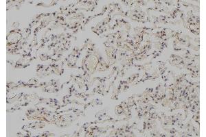 ABIN6273570 at 1/100 staining Human lung tissue by IHC-P. (SNAPC3 Antikörper  (C-Term))