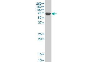 GRK6 monoclonal antibody (M10), clone 8D4 Western Blot analysis of GRK6 expression in Jurkat . (GRK6 Antikörper  (AA 71-170))