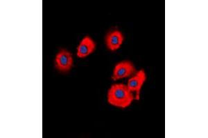 Immunofluorescent analysis of OLFML2B staining in HuvEc cells. (OLFML2B Antikörper  (Center))