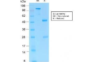 SDS-PAGE Analysis Purified PD1 (CD279) Rabbit Monoclonal Antibody (PDCD1/1410R). (Rekombinanter PD-1 Antikörper)